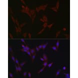 Immunofluorescence - Anti-SLC39A14/ZIP-14 Antibody (A8608) - Antibodies.com