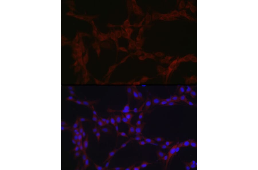 Immunofluorescence - Anti-SLC39A14/ZIP-14 Antibody (A8608) - Antibodies.com