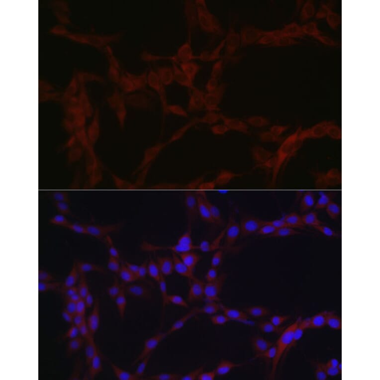 Immunofluorescence - Anti-SLC39A14/ZIP-14 Antibody (A8608) - Antibodies.com