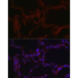 Immunofluorescence - Anti-SLC39A14/ZIP-14 Antibody (A8608) - Antibodies.com