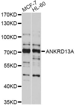 Western blot analysis of extracts of various cell lines, using Anti-ANKRD13A Antibody (A10416) at 1:1,000 dilution.
Secondary antibody: Goat Anti-Rabbit IgG (H+L) (HRP) (AS014) at 1:10,000 dilution.
Lysates / proteins: 25µg per lane.
Blocking buffer: 3% non-fat dry milk in TBST.
Detection: ECL Basic Kit (RM00020).
Exposure time: 10s.