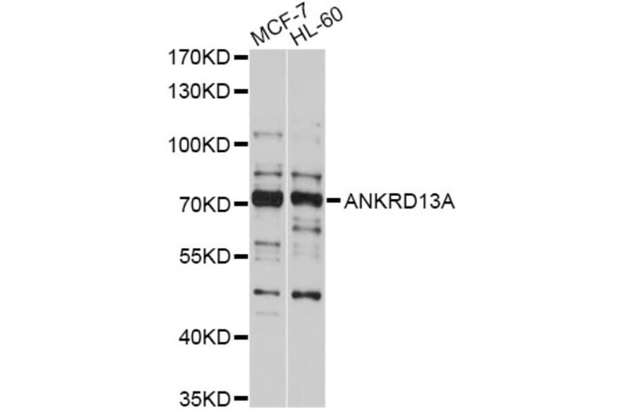 Western Blot - Anti-ANKRD13A Antibody (A10416) - Antibodies.com
