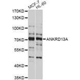 Western Blot - Anti-ANKRD13A Antibody (A10416) - Antibodies.com