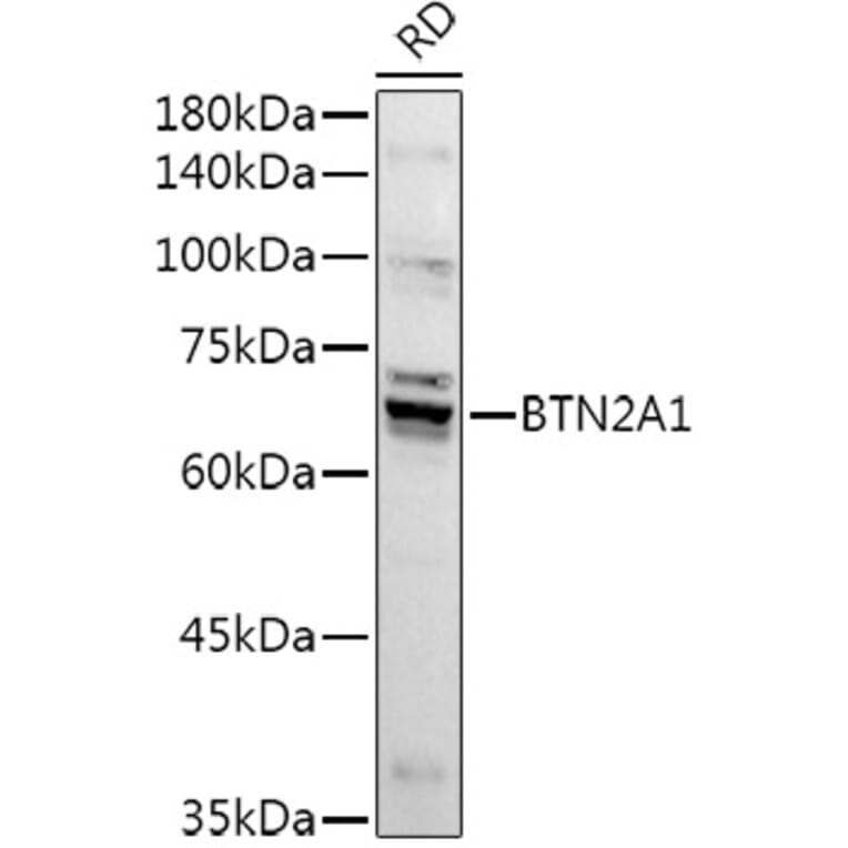 Western Blot - Anti-BTN2A1 Antibody (A8611) - Antibodies.com