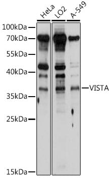 Western blot analysis of extracts of various cell lines, using Anti-C10orf54 Antibody (A10419) at 1:1,000 dilution.
Secondary antibody: Goat Anti-Rabbit IgG (H+L) (HRP) (AS014) at 1:10,000 dilution.
Lysates / proteins: 25µg per lane.
Blocking buffer: 3% non-fat dry milk in TBST.
Detection: ECL Basic Kit (RM00020).
Exposure time: 10s.