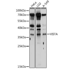 Western Blot - Anti-VISTA Antibody (A8612) - Antibodies.com