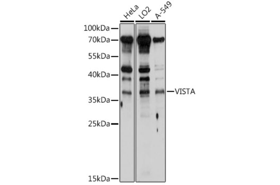 Western Blot - Anti-VISTA Antibody (A8612) - Antibodies.com