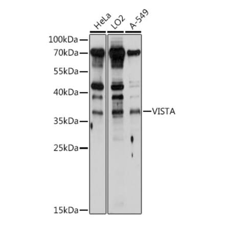 Western Blot - Anti-VISTA Antibody (A8612) - Antibodies.com