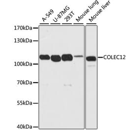 Western Blot - Anti-COLEC12 Antibody (A8613) - Antibodies.com