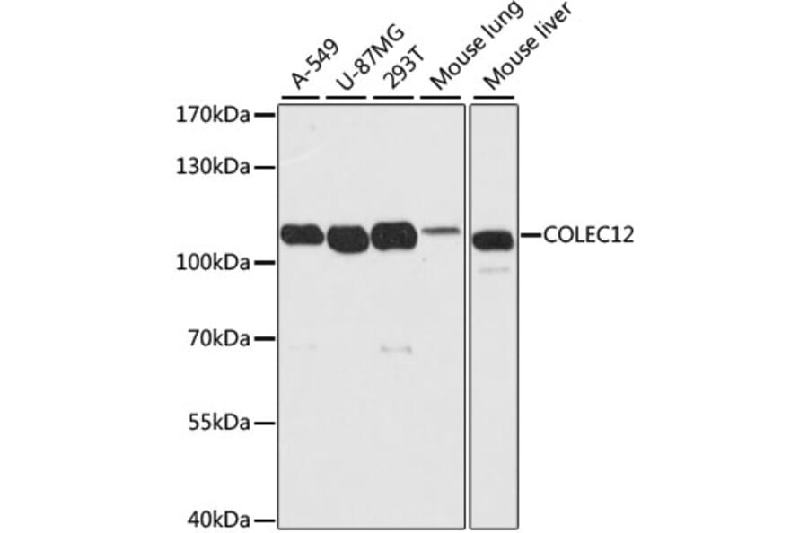 Western Blot - Anti-COLEC12 Antibody (A8613) - Antibodies.com