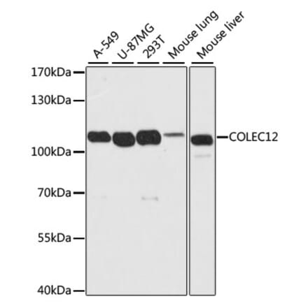 Western Blot - Anti-COLEC12 Antibody (A8613) - Antibodies.com