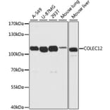 Western Blot - Anti-COLEC12 Antibody (A8613) - Antibodies.com