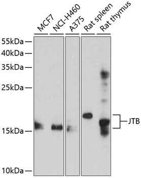 Western blot analysis of extracts of various cell lines, using Anti-JTB Antibody (A10427) at 1:1,000 dilution.
Secondary antibody: Goat Anti-Rabbit IgG (H+L) (HRP) (AS014) at 1:10,000 dilution.
Lysates / proteins: 25µg per lane.
Blocking buffer: 3% non-fat dry milk in TBST.
Detection: ECL Enhanced Kit (RM00021).
Exposure time: 60s.
