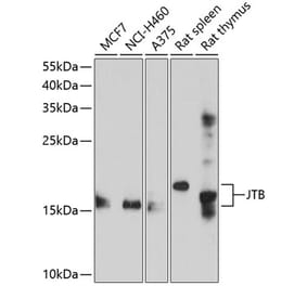 Western Blot - Anti-JTB Antibody (A8615) - Antibodies.com