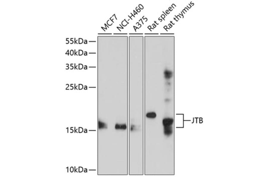 Western Blot - Anti-JTB Antibody (A8615) - Antibodies.com