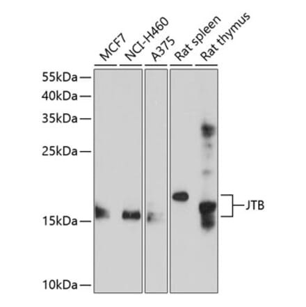 Western Blot - Anti-JTB Antibody (A8615) - Antibodies.com