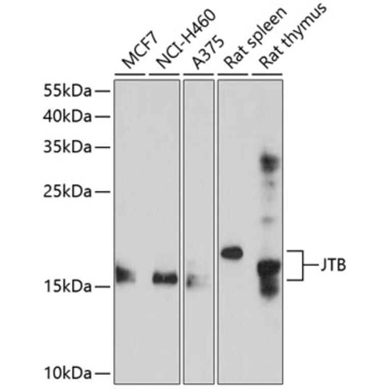Western Blot - Anti-JTB Antibody (A8615) - Antibodies.com