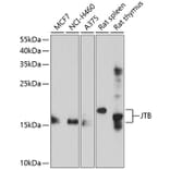 Western Blot - Anti-JTB Antibody (A8615) - Antibodies.com