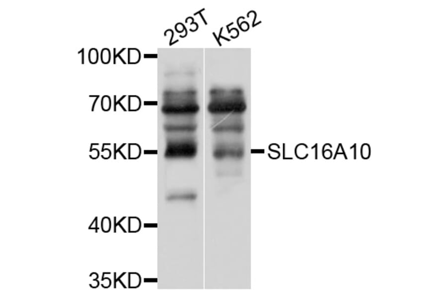 Western Blot - Anti-SLC16A10 Antibody (A10433) - Antibodies.com