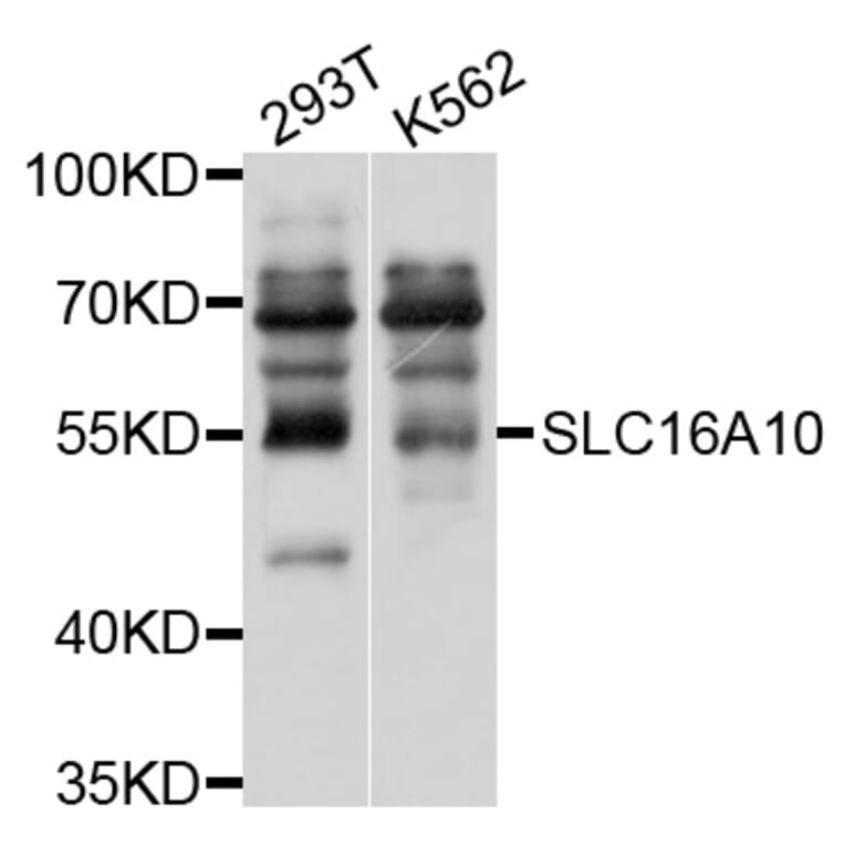 Western Blot - Anti-SLC16A10 Antibody (A10433) - Antibodies.com