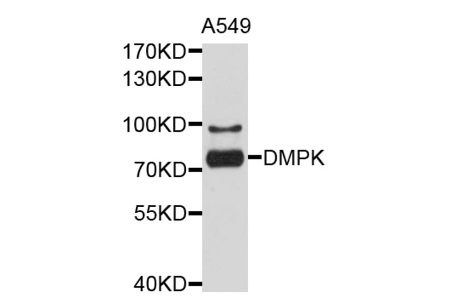 Western Blot - Anti-DMPK Antibody (A10442) - Antibodies.com