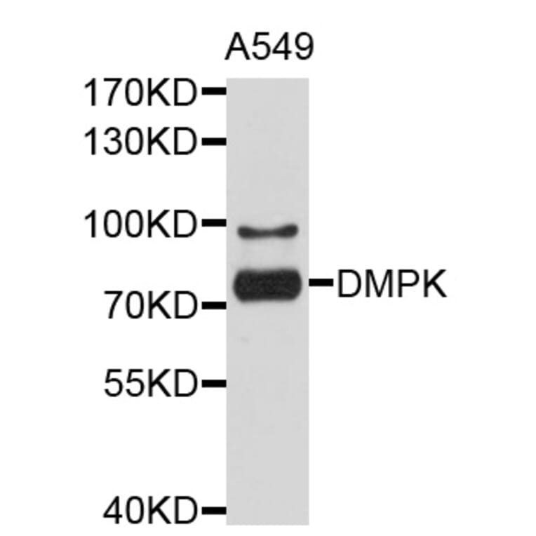 Western Blot - Anti-DMPK Antibody (A10442) - Antibodies.com