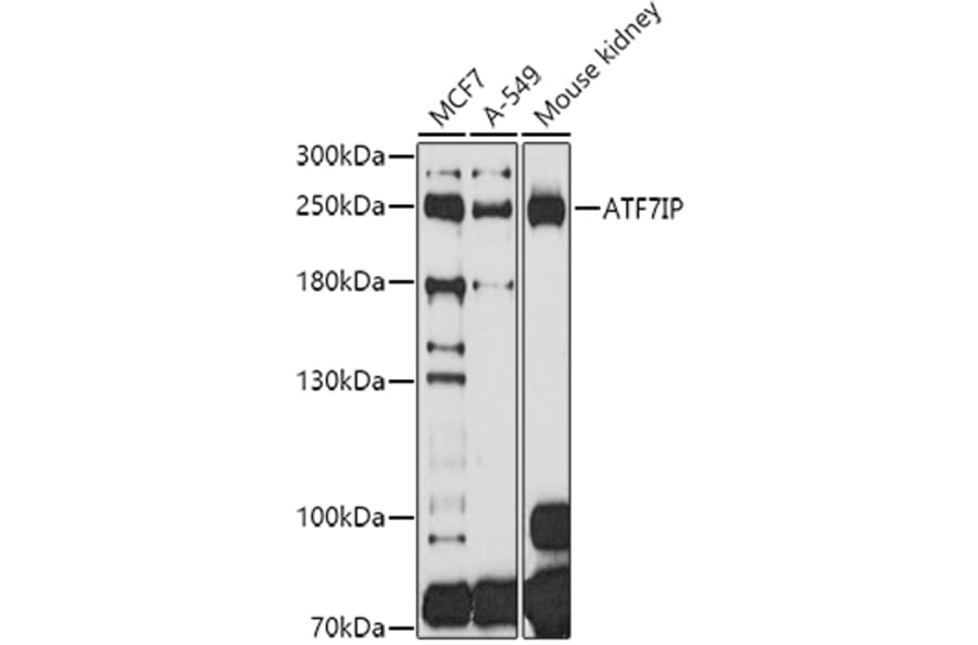 Western Blot - Anti-MCAF1 Antibody (A8620) - Antibodies.com
