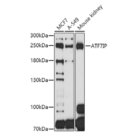 Western Blot - Anti-MCAF1 Antibody (A8620) - Antibodies.com