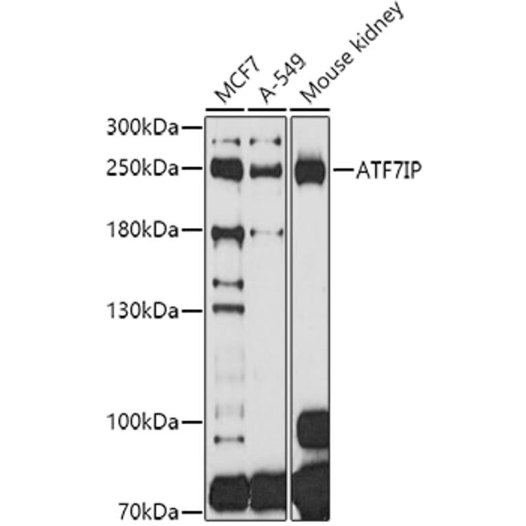 Western Blot - Anti-MCAF1 Antibody (A8620) - Antibodies.com
