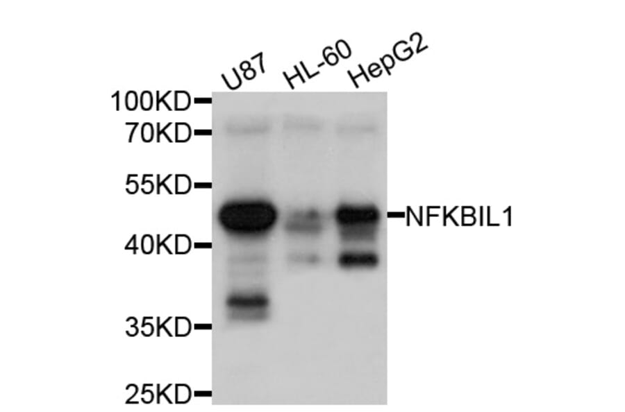 Western Blot - Anti-NFKBIL1 Antibody (A10456) - Antibodies.com
