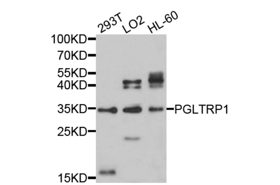 Western Blot - Anti-PGLYRP1 Antibody (A10460) - Antibodies.com