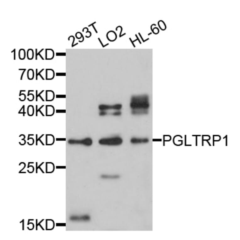 Western Blot - Anti-PGLYRP1 Antibody (A10460) - Antibodies.com