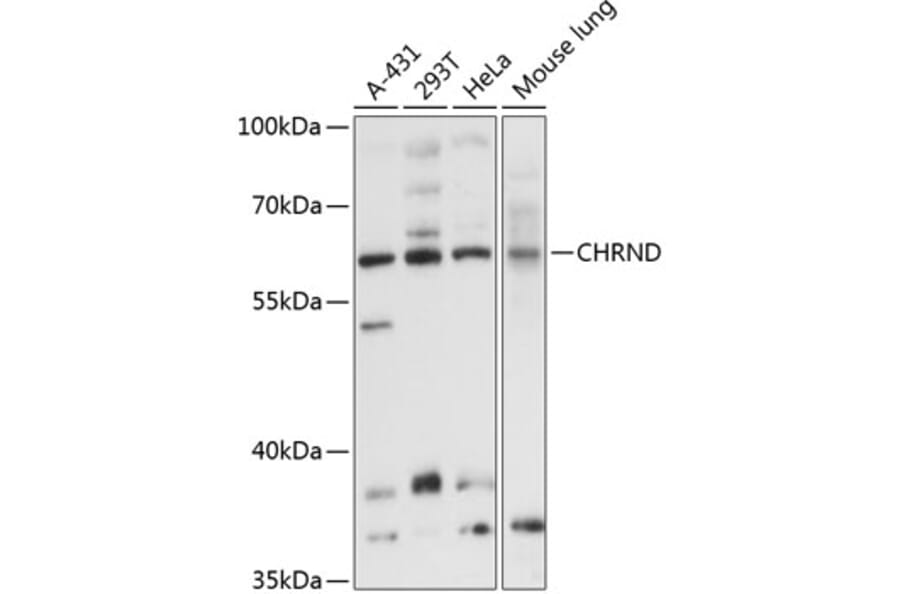 Western Blot - Anti-CHRND Antibody (A8623) - Antibodies.com