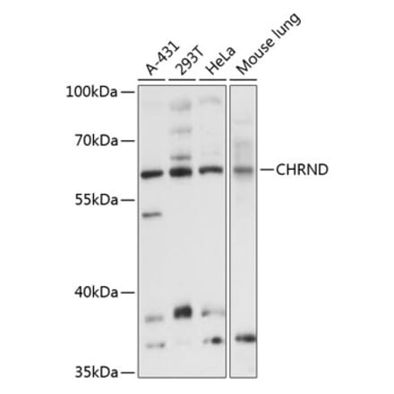 Western Blot - Anti-CHRND Antibody (A8623) - Antibodies.com