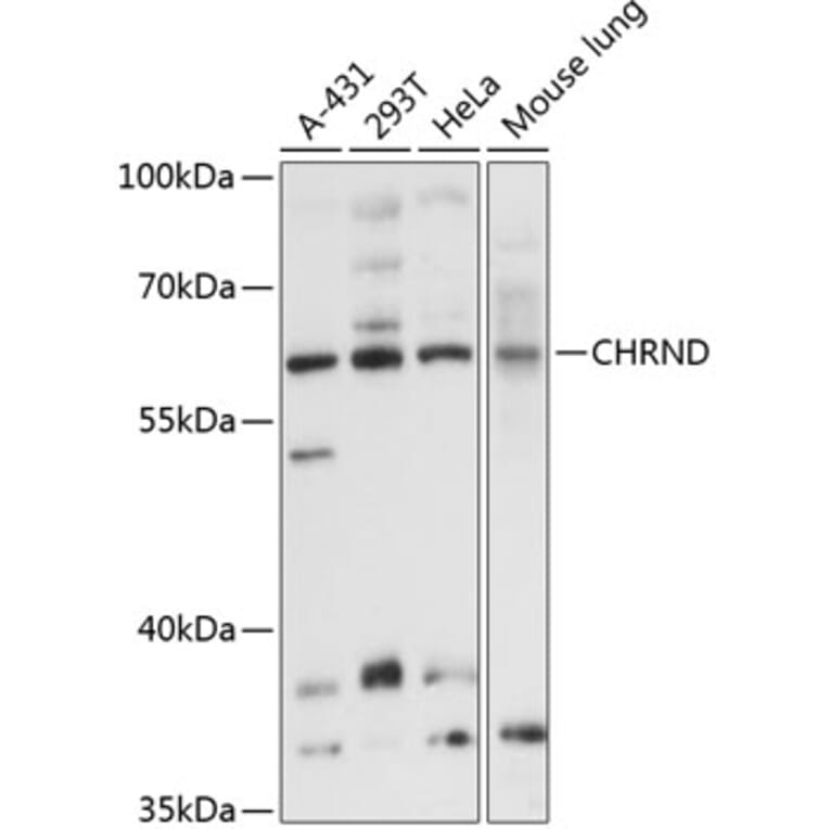 Western Blot - Anti-CHRND Antibody (A8623) - Antibodies.com