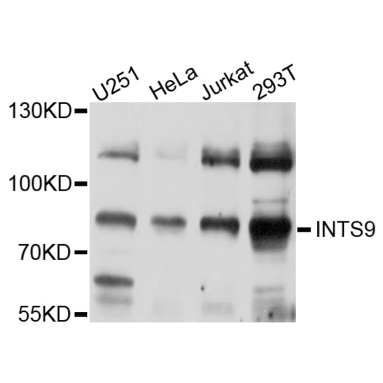 Western Blot - Anti-INTS9 Antibody (A10480) - Antibodies.com