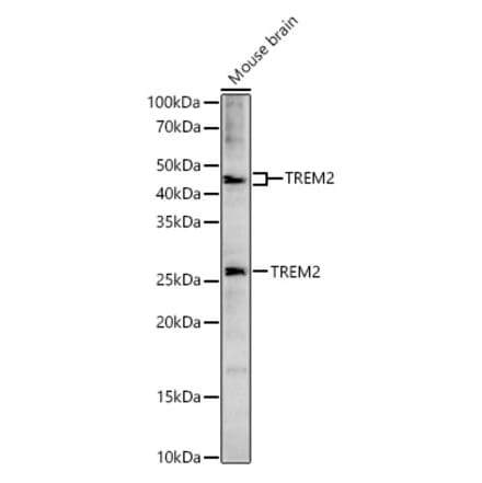 Western Blot - Anti-TREM2 Antibody (A8628) - Antibodies.com