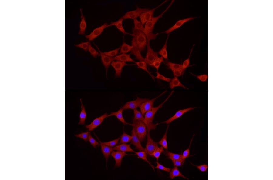 Immunofluorescence - Anti-TREM2 Antibody (A8628) - Antibodies.com