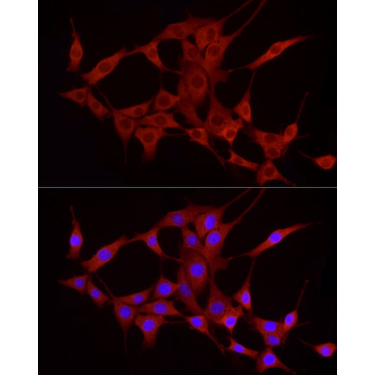 Immunofluorescence - Anti-TREM2 Antibody (A8628) - Antibodies.com