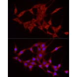Immunofluorescence - Anti-TREM2 Antibody (A8628) - Antibodies.com