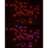 Immunofluorescence - Anti-TREM2 Antibody (A8628) - Antibodies.com