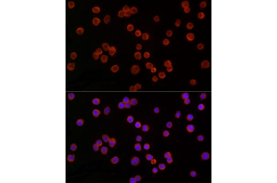 Immunofluorescence - Anti-TREM2 Antibody (A8628) - Antibodies.com
