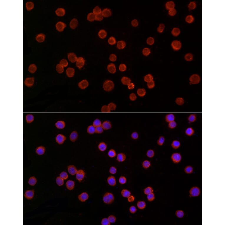 Immunofluorescence - Anti-TREM2 Antibody (A8628) - Antibodies.com