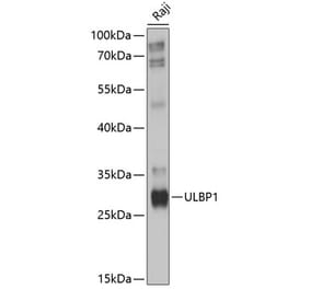 Western Blot - Anti-ULBP1 Antibody (A8629) - Antibodies.com