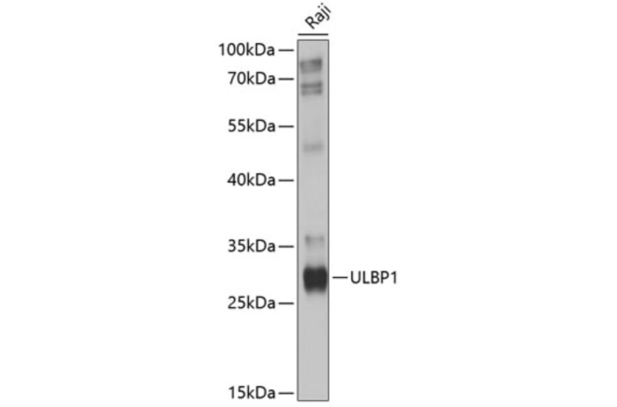 Western Blot - Anti-ULBP1 Antibody (A8629) - Antibodies.com