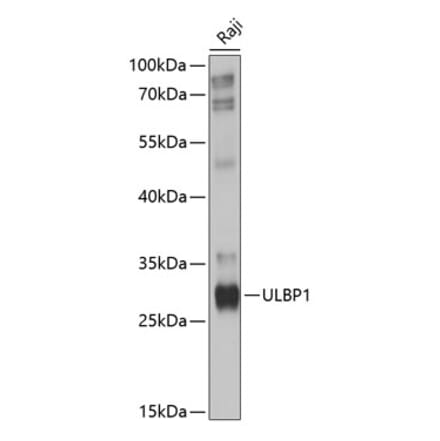 Western Blot - Anti-ULBP1 Antibody (A8629) - Antibodies.com