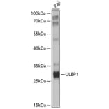 Western Blot - Anti-ULBP1 Antibody (A8629) - Antibodies.com