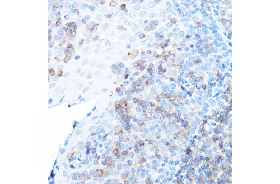 Immunohistochemistry - Anti-ULBP1 Antibody (A8629) - Antibodies.com