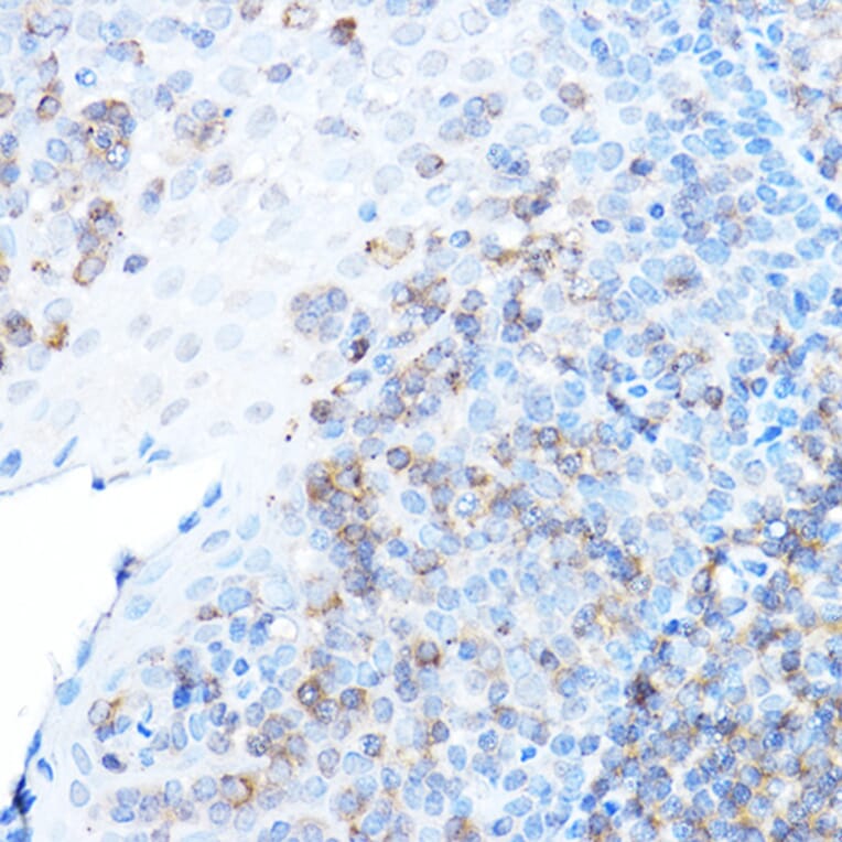 Immunohistochemistry - Anti-ULBP1 Antibody (A8629) - Antibodies.com