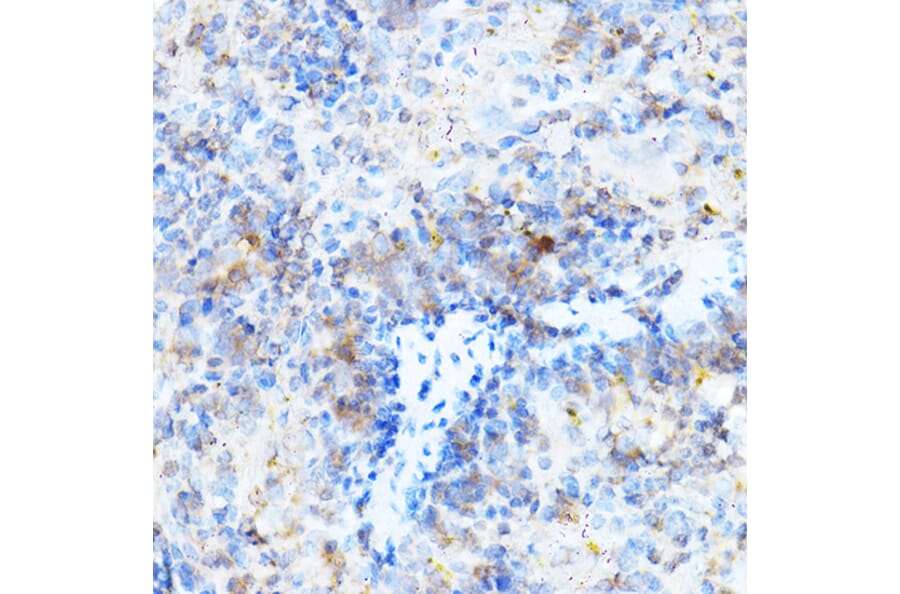 Immunohistochemistry - Anti-ULBP1 Antibody (A8629) - Antibodies.com